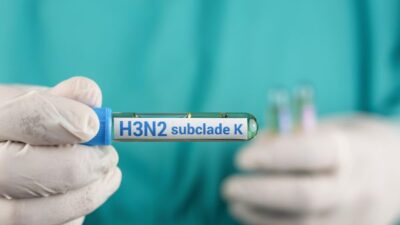 74 Kasus Influenza H3N2 Subclade K, Kemenkes Catat Tren Nasional Menurun