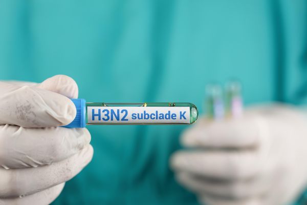 74 Kasus Influenza H3N2 Subclade K, Kemenkes Catat Tren Nasional Menurun